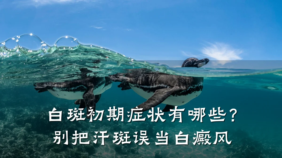 白斑初期症状有哪些?别把汗斑误当白癜风