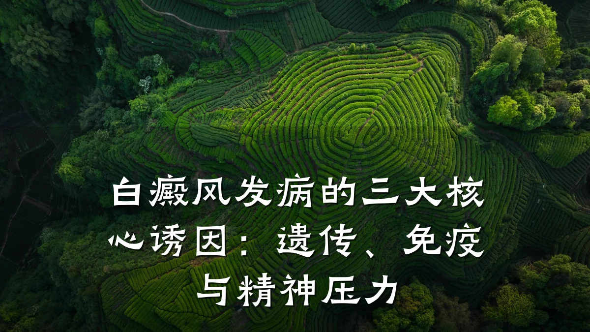 白癜风发病的三大核心诱因:遗传、免疫与精神压力