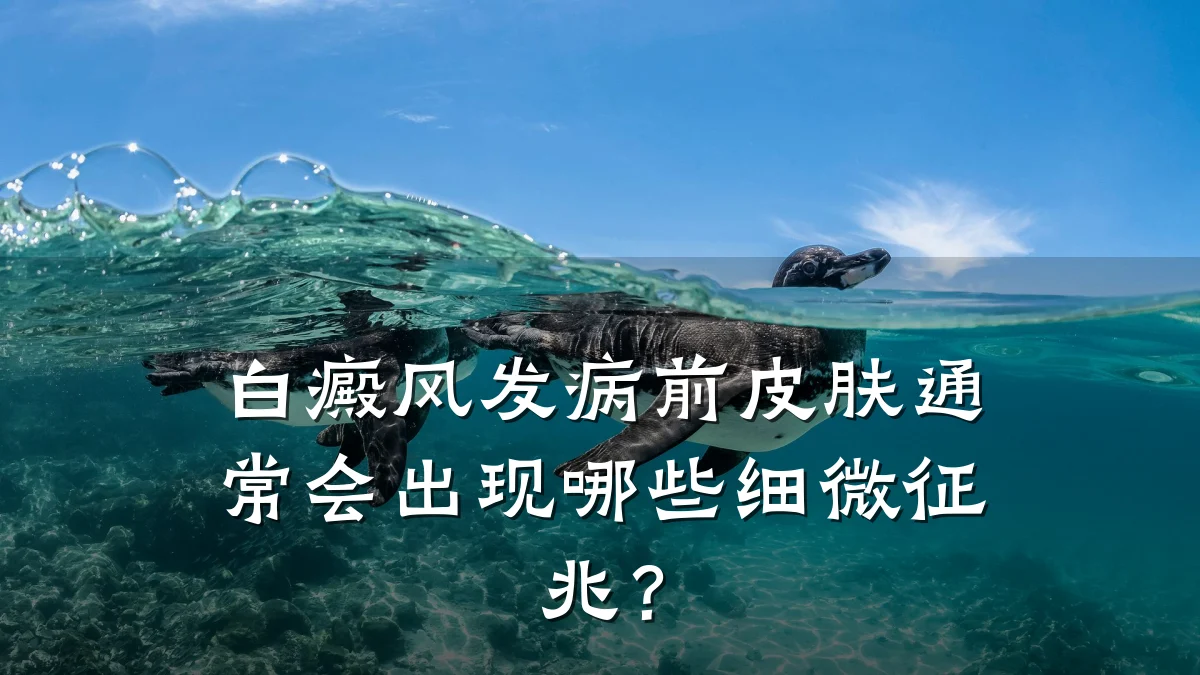 白癜风发病前皮肤通常会出现哪些细微征兆?