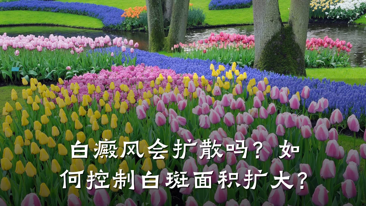 白癜风会扩散吗?如何控制白斑面积扩大?