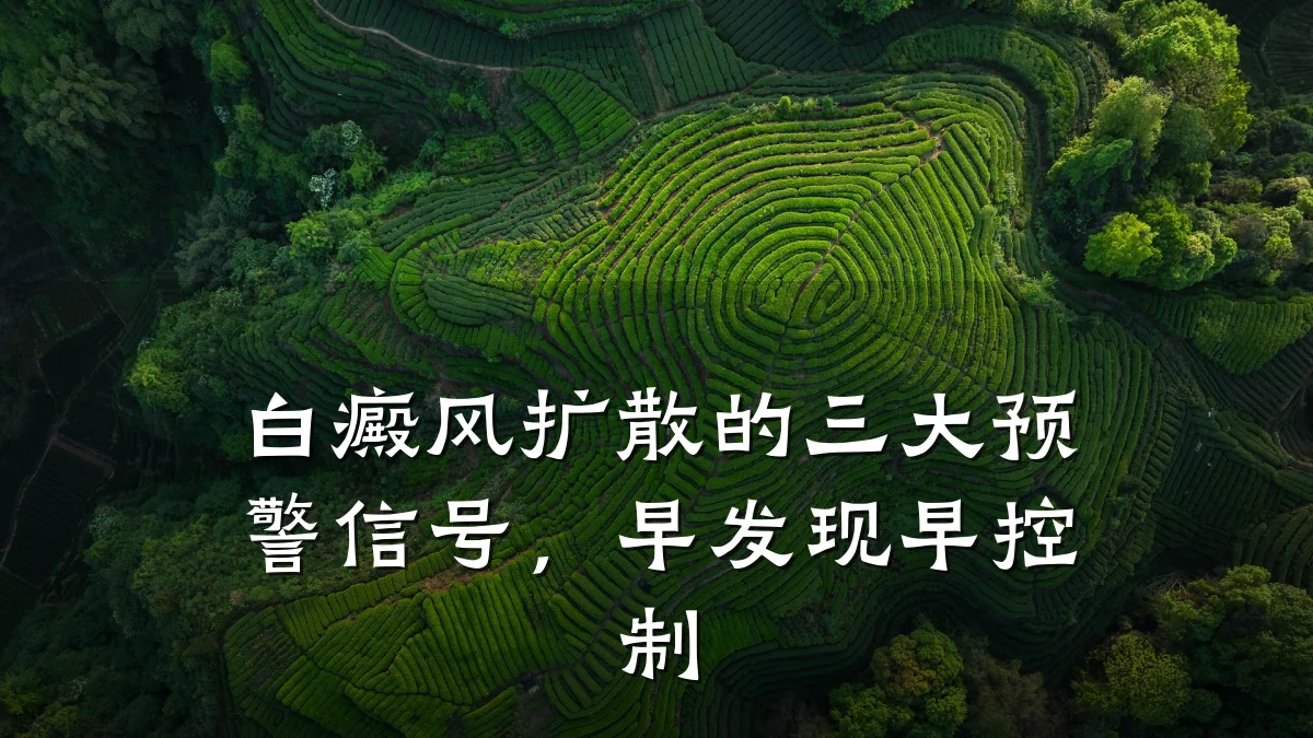 白癜风扩散的三大预警信号,早发现早控制