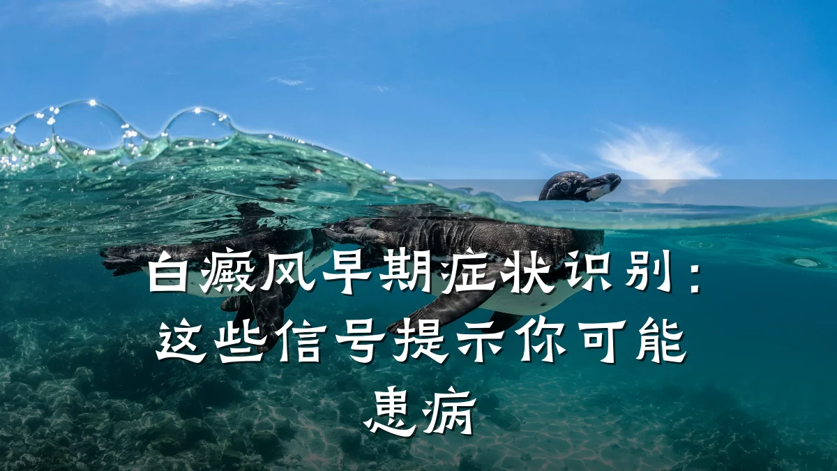 白癜风早期症状识别：这些信号提示你可能患病
