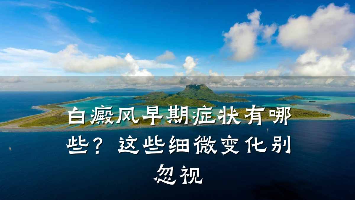 白癜风早期症状有哪些?这些细微变化别忽视