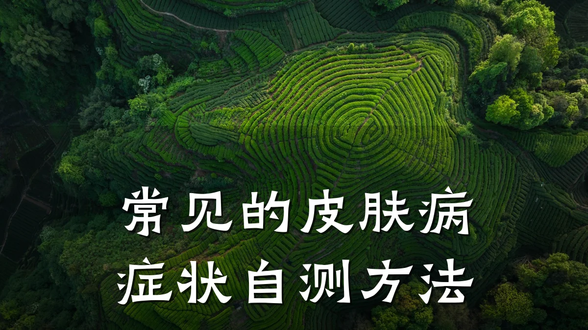 常见的皮肤病症状自测方法