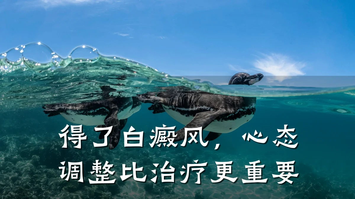 得了白癜风,心态调整比治疗更重要