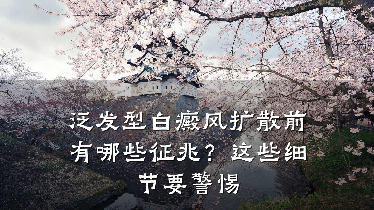 泛发型白癜风扩散前有哪些征兆？这些细节要警惕