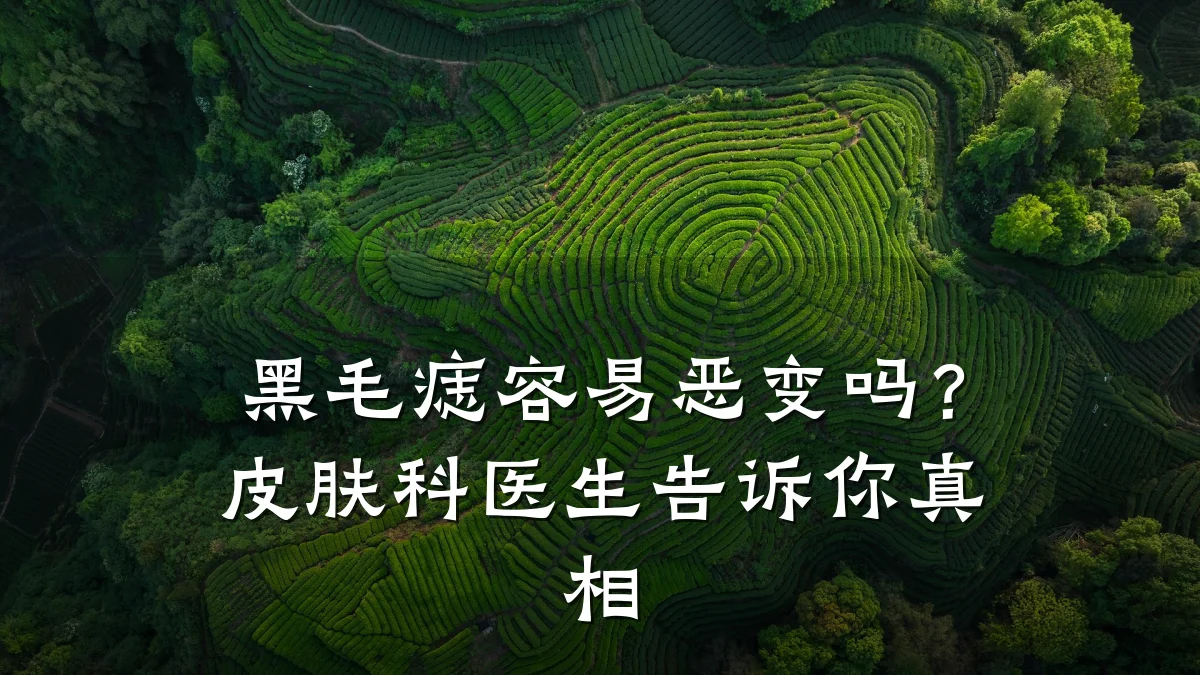 黑毛痣容易恶变吗？皮肤科医生告诉你真相
