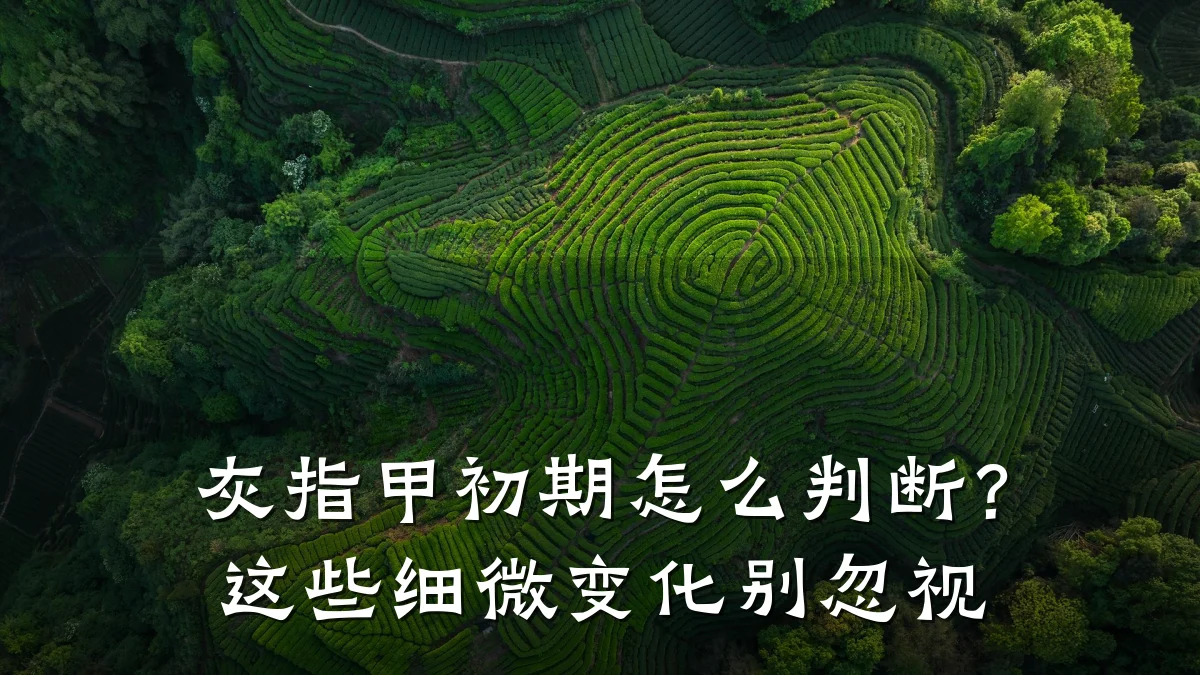 灰指甲初期怎么判断?这些细微变化别忽视