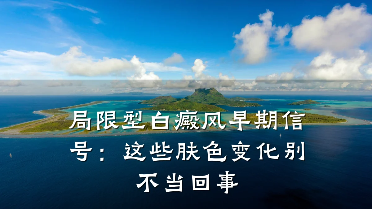 局限型白癜风早期信号:这些肤色变化别不当回事