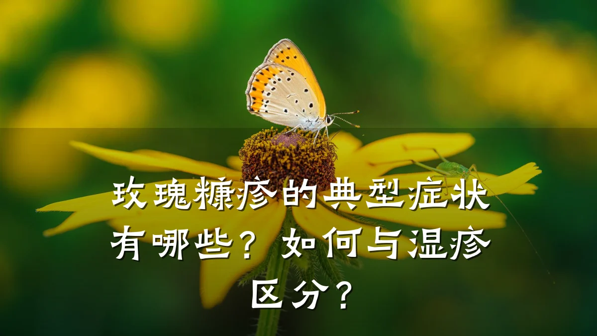 玫瑰糠疹的典型症状有哪些？如何与湿疹区分？