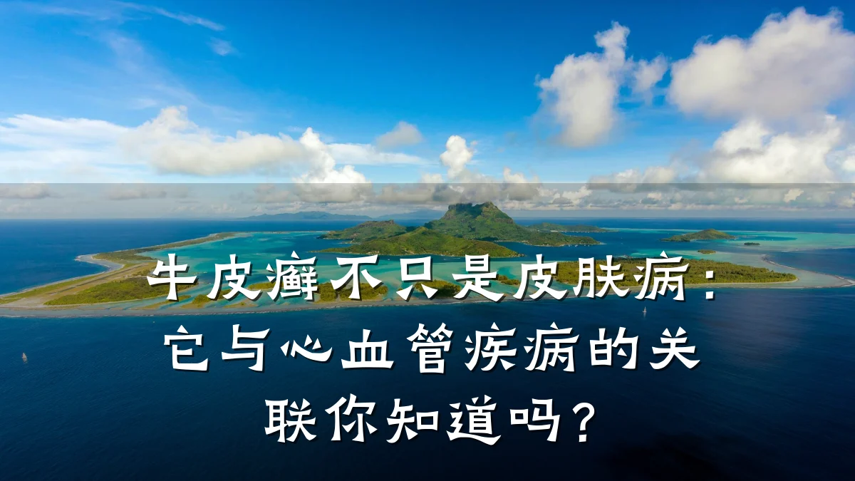 牛皮癣不只是皮肤病：它与心血管疾病的关联你知道吗？