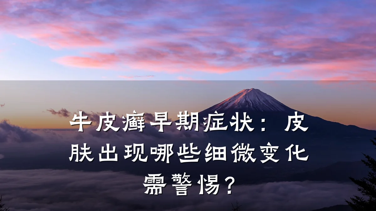 牛皮癣早期症状:皮肤出现哪些细微变化需警惕?