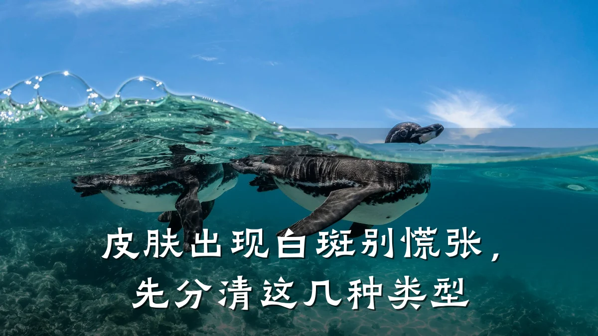 皮肤出现白斑别慌张，先分清这几种类型