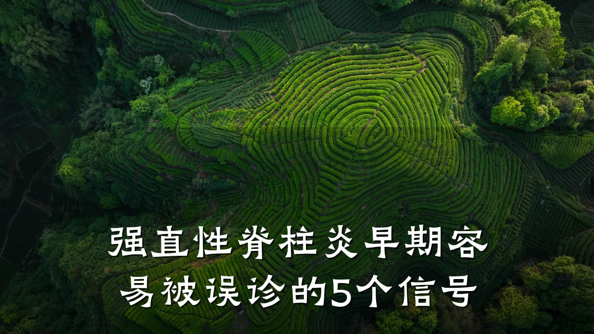 强直性脊柱炎早期容易被误诊的5个信号