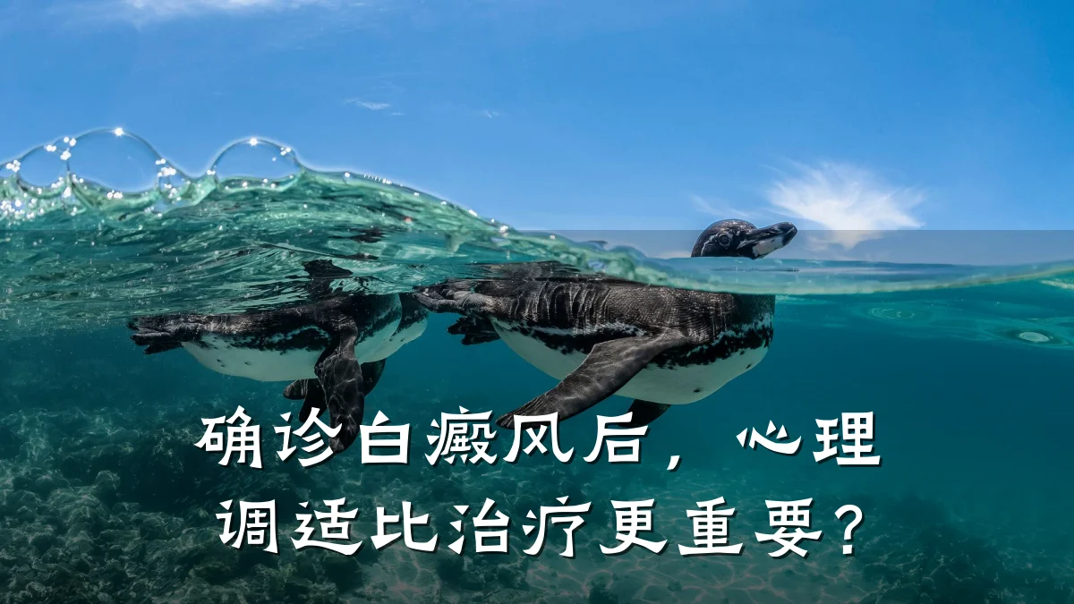 确诊白癜风后,心理调适比治疗更重要?