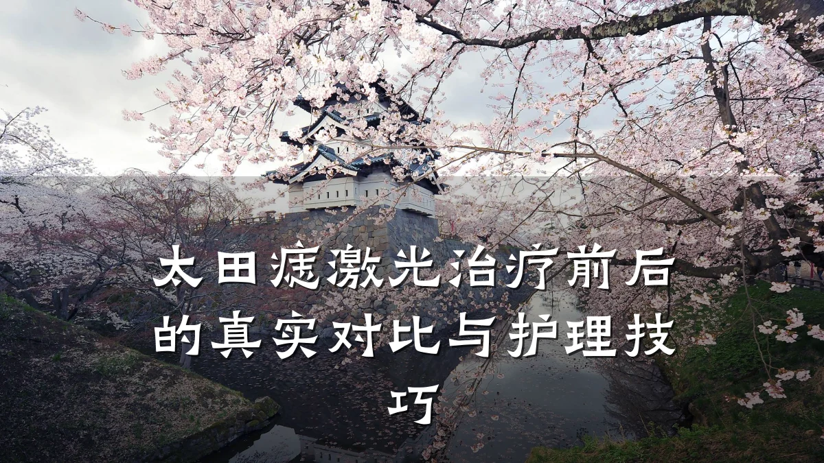 太田痣激光治疗前后的真实对比与护理技巧