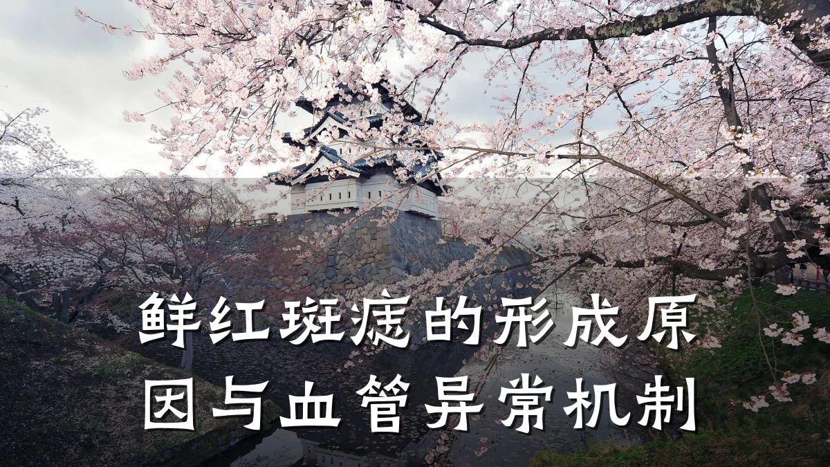 鲜红斑痣的形成原因与血管异常机制