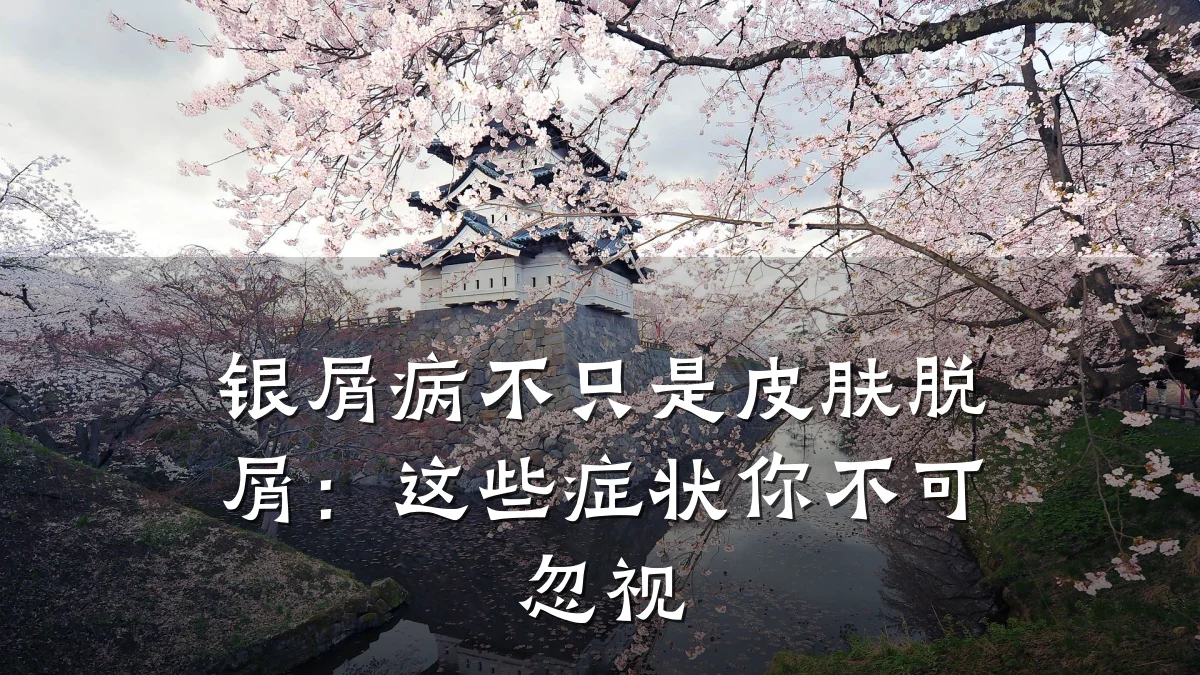 银屑病不只是皮肤脱屑:这些症状你不可忽视