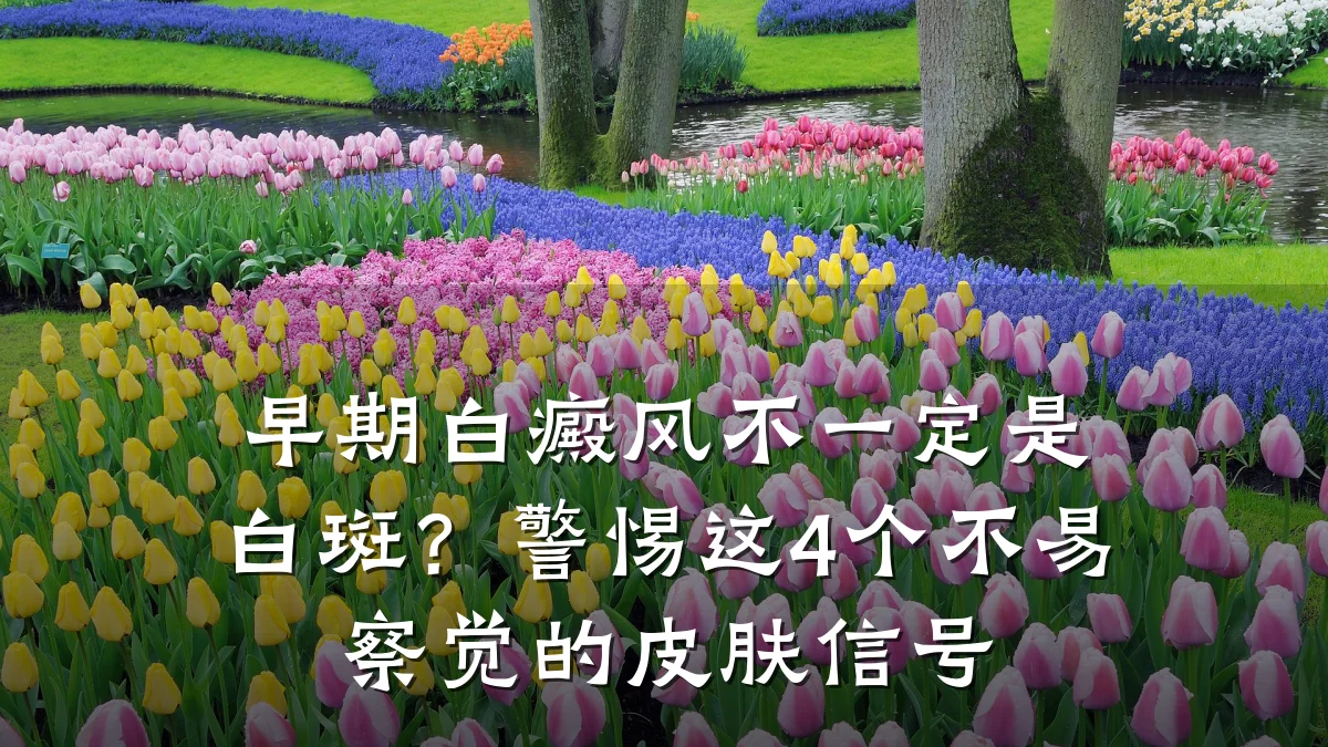 早期白癜风不一定是白斑?警惕这4个不易察觉的皮肤信号