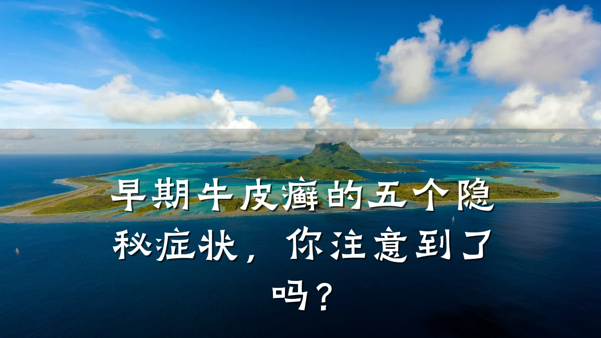 早期牛皮癣的五个隐秘症状,你注意到了吗?