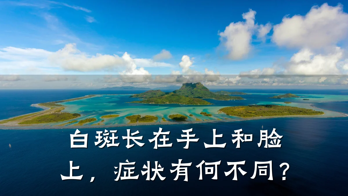 白斑长在手上和脸上,症状有何不同?