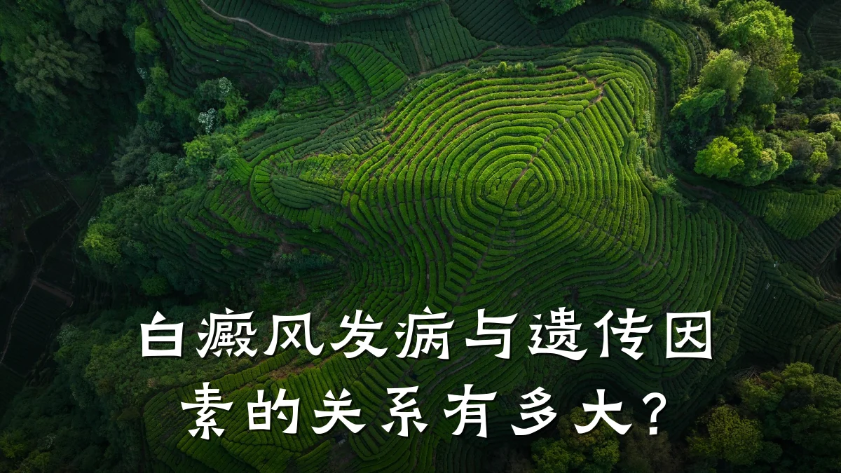白癜风发病与遗传因素的关系有多大?