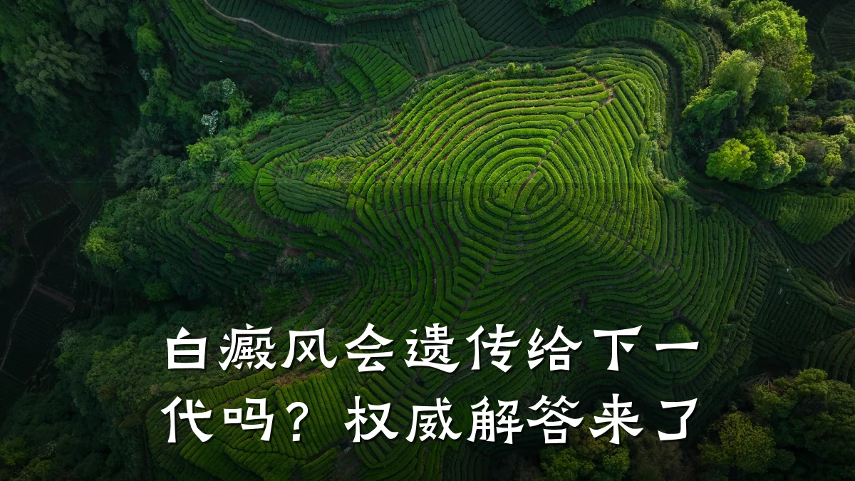 白癜风会遗传给下一代吗?权威解答来了