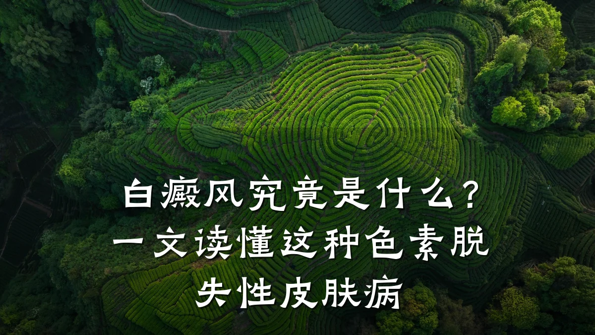 白癜风究竟是什么?一文读懂这种色素脱失性皮肤病