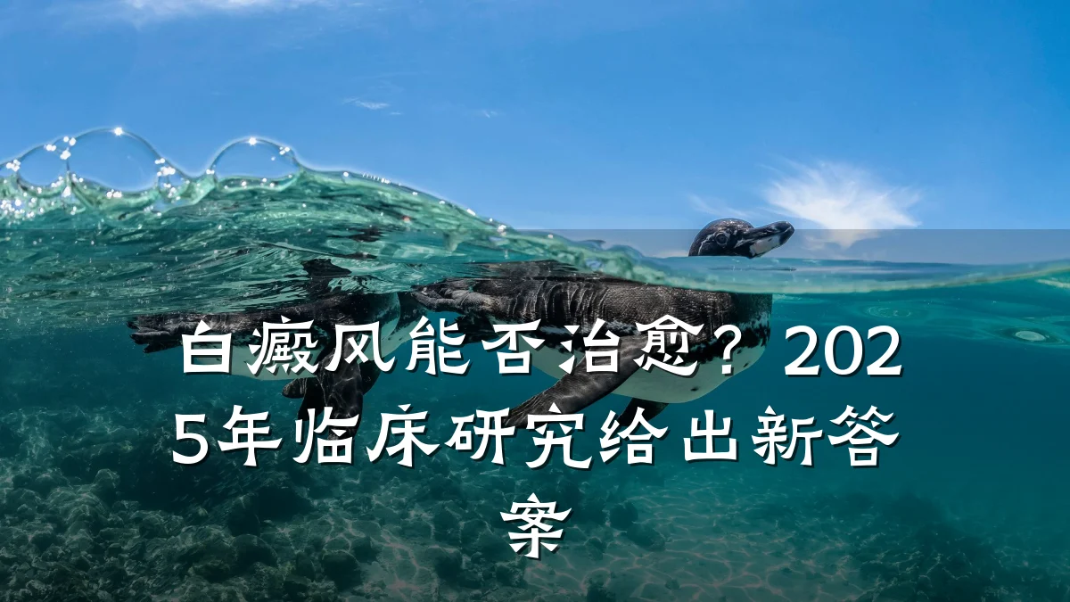 白癜风能否治愈?2025年临床研究给出新答案