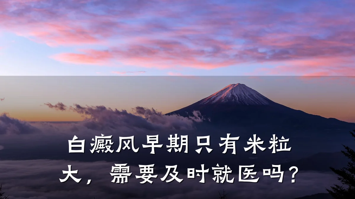 白癜风早期只有米粒大,需要及时就医吗?