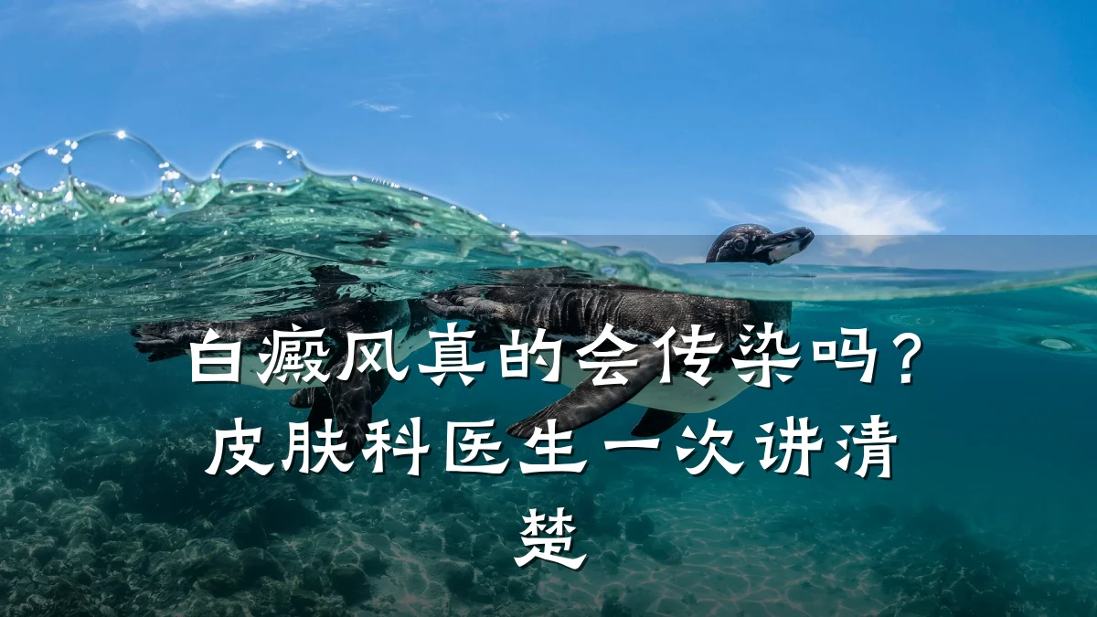 白癜风真的会传染吗?皮肤科医生一次讲清楚