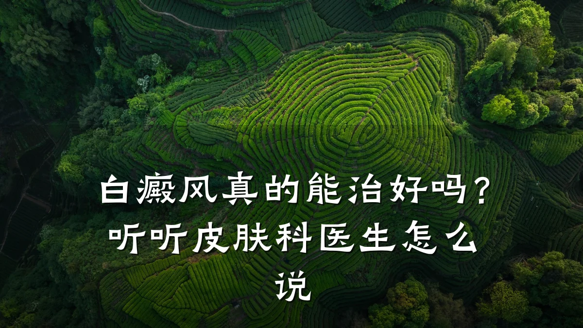 白癜风真的能治好吗?听听皮肤科医生怎么说