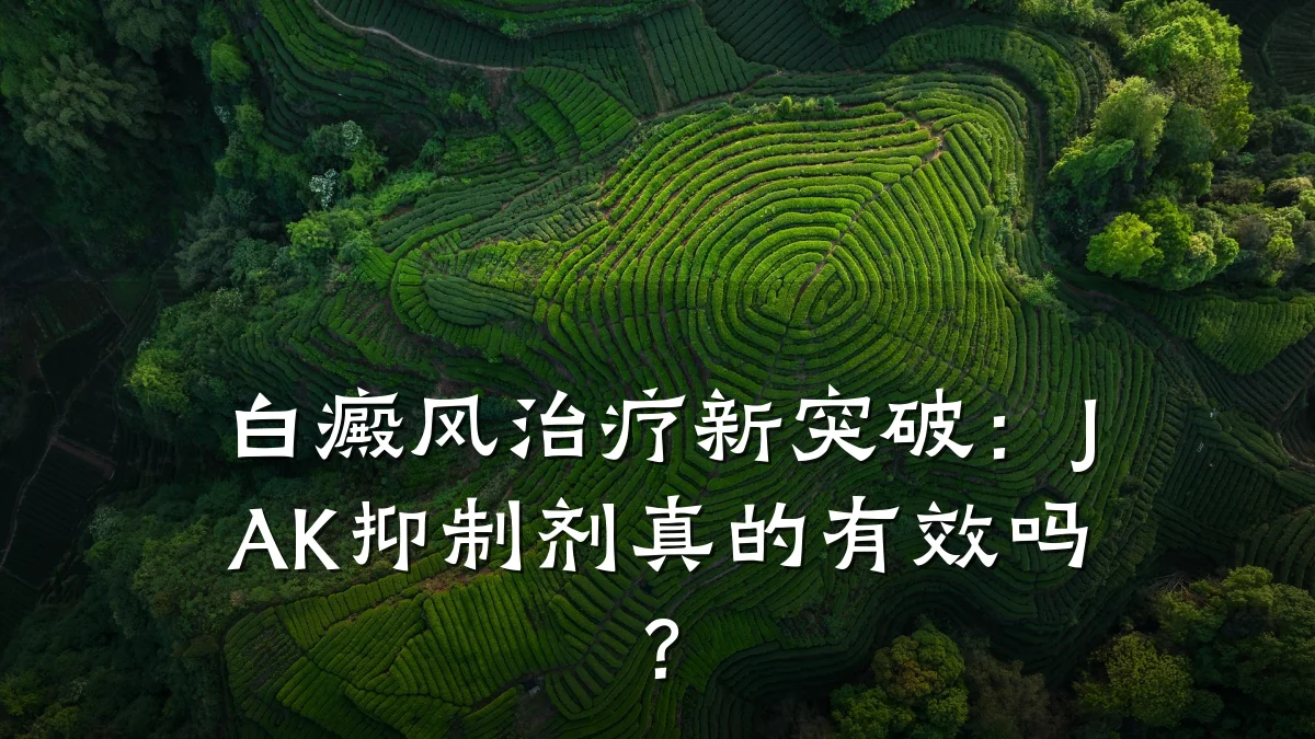 白癜风治疗新突破:JAK抑制剂真的有效吗?