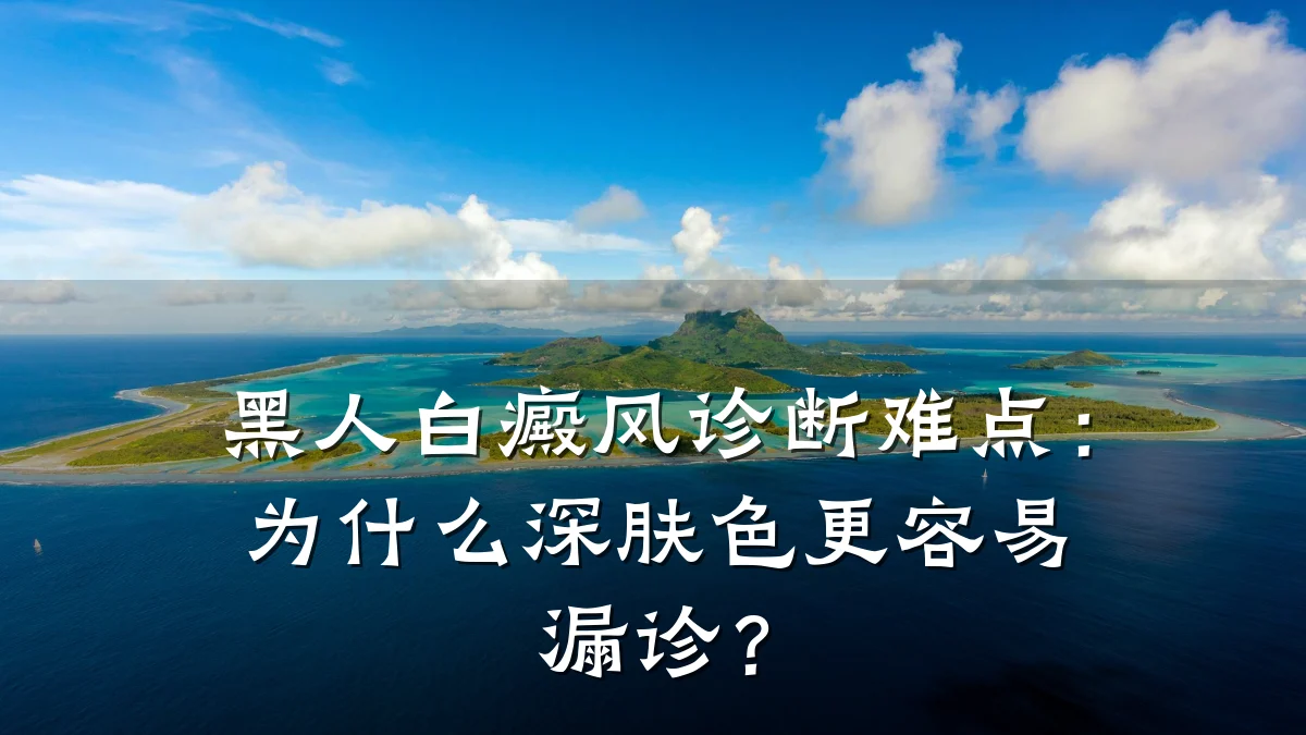 黑人白癜风诊断难点:为什么深肤色更容易漏诊?