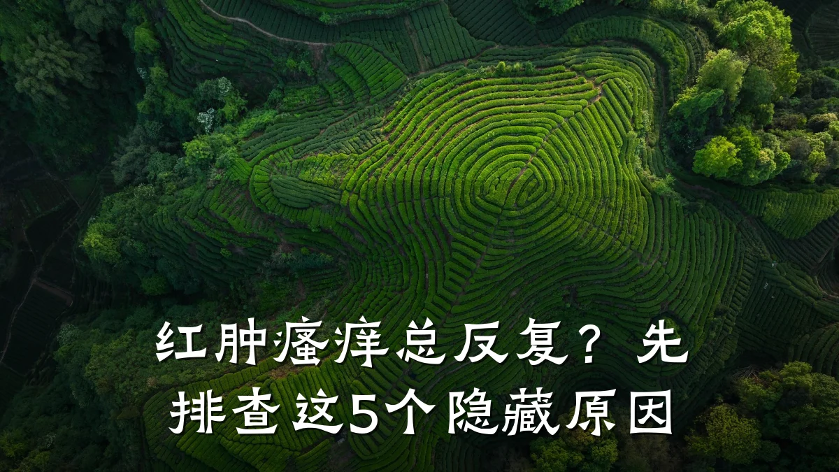 红肿瘙痒总反复?先排查这5个隐藏原因