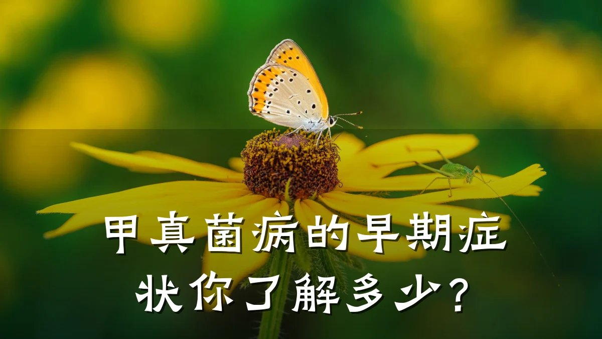 甲真菌病的早期症状你了解多少?