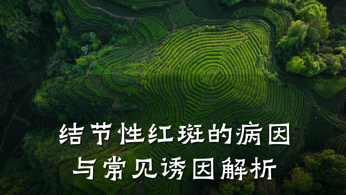 结节性红斑的病因与常见诱因解析