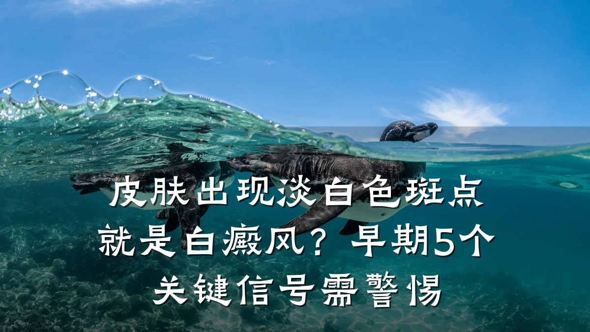 皮肤出现淡白色斑点就是白癜风?早期5个关键信号需警惕