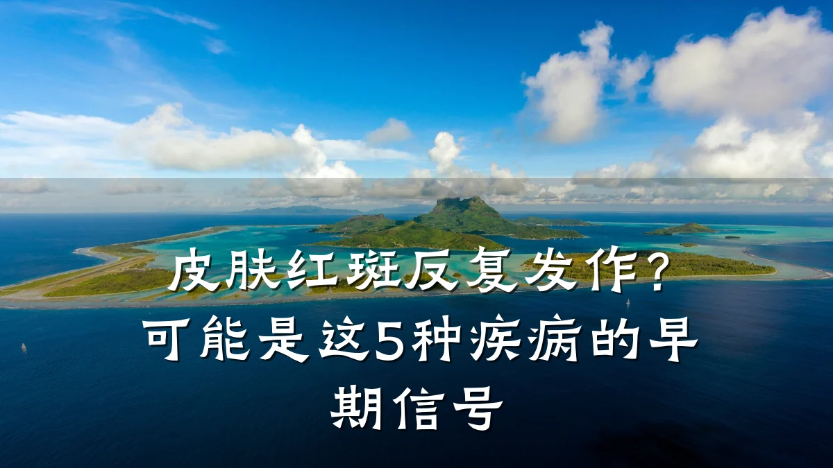 皮肤红斑反复发作?可能是这5种疾病的早期信号