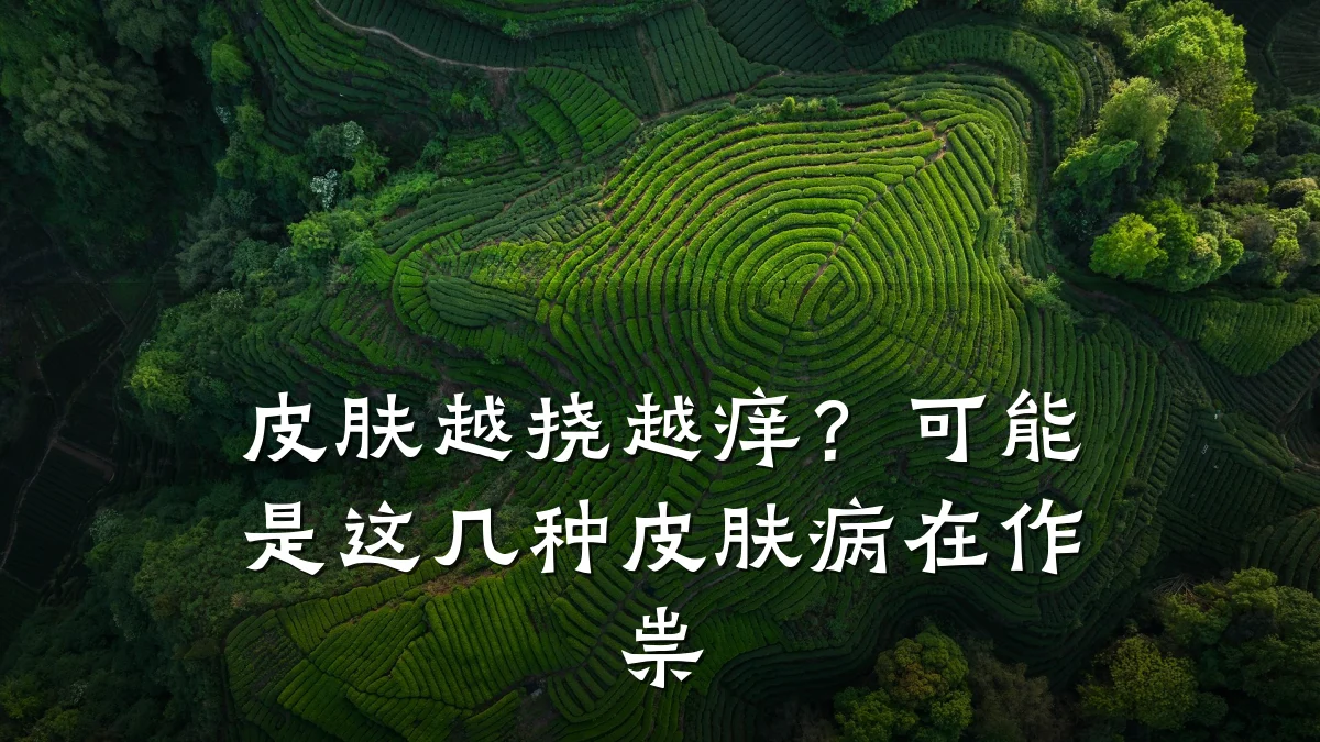 皮肤越挠越痒？可能是这几种皮肤病在作祟