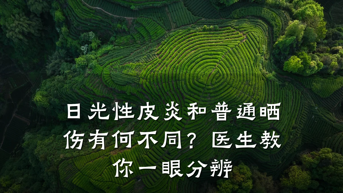 日光性皮炎和普通晒伤有何不同?医生教你一眼分辨