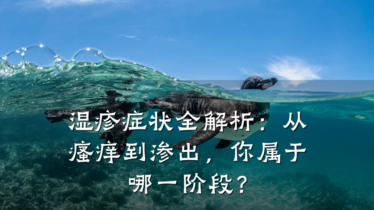 湿疹症状全解析:从瘙痒到渗出,你属于哪一阶段?