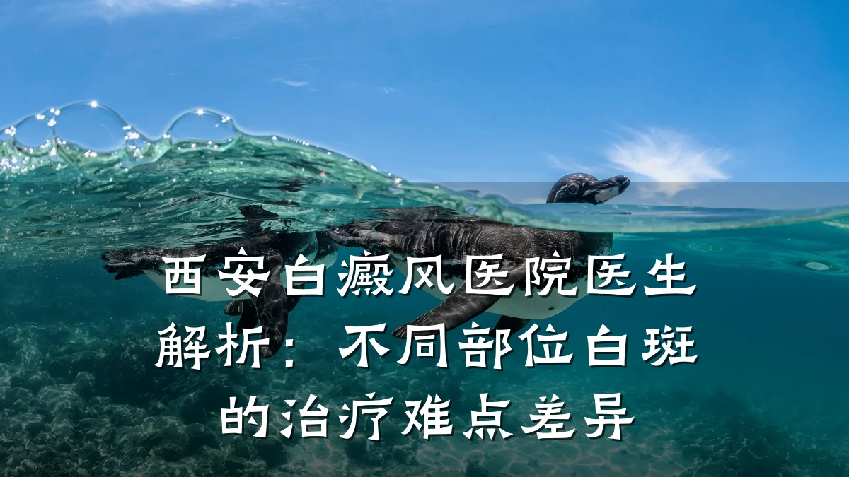 西安白癜风医院医生解析:不同部位白斑的治疗难点差异