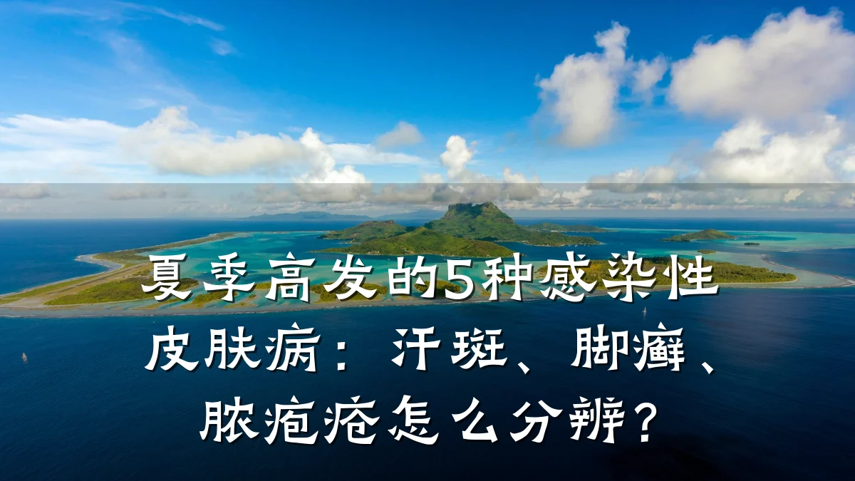 夏季高发的5种感染性皮肤病:汗斑、脚癣、脓疱疮怎么分辨?