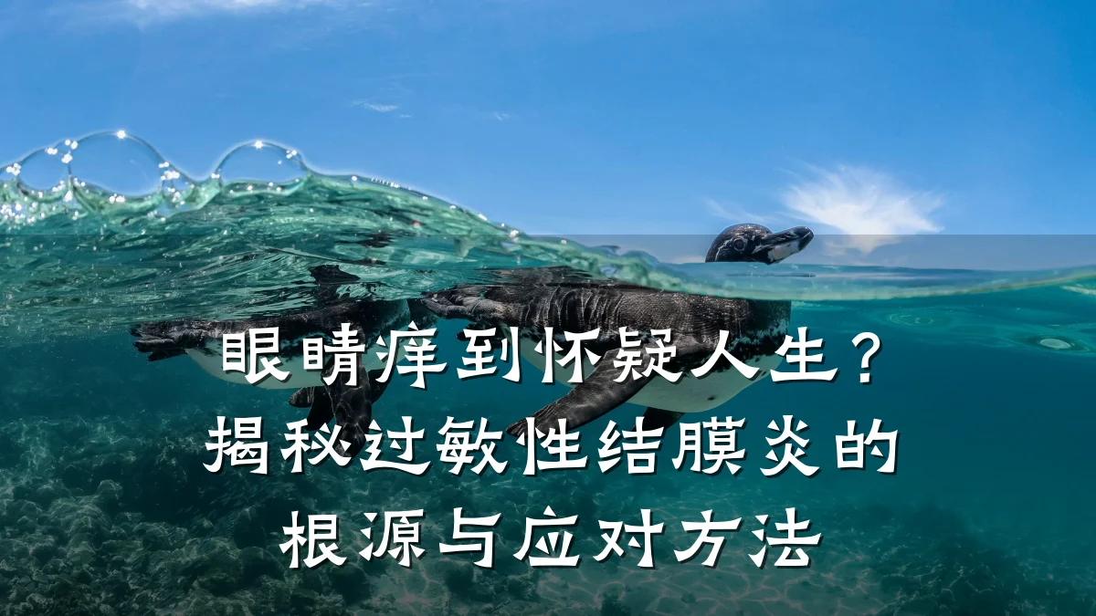 眼睛痒到怀疑人生？揭秘过敏性结膜炎的根源与应对方法