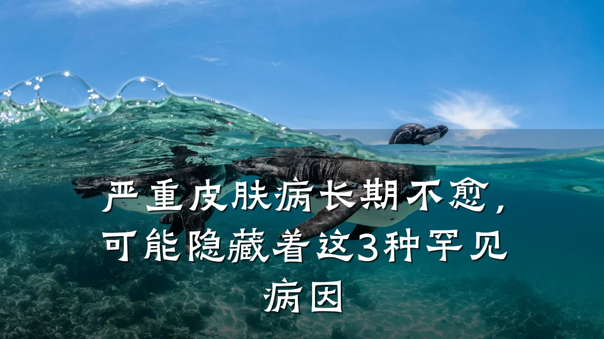 严重皮肤病长期不愈,可能隐藏着这3种罕见病因