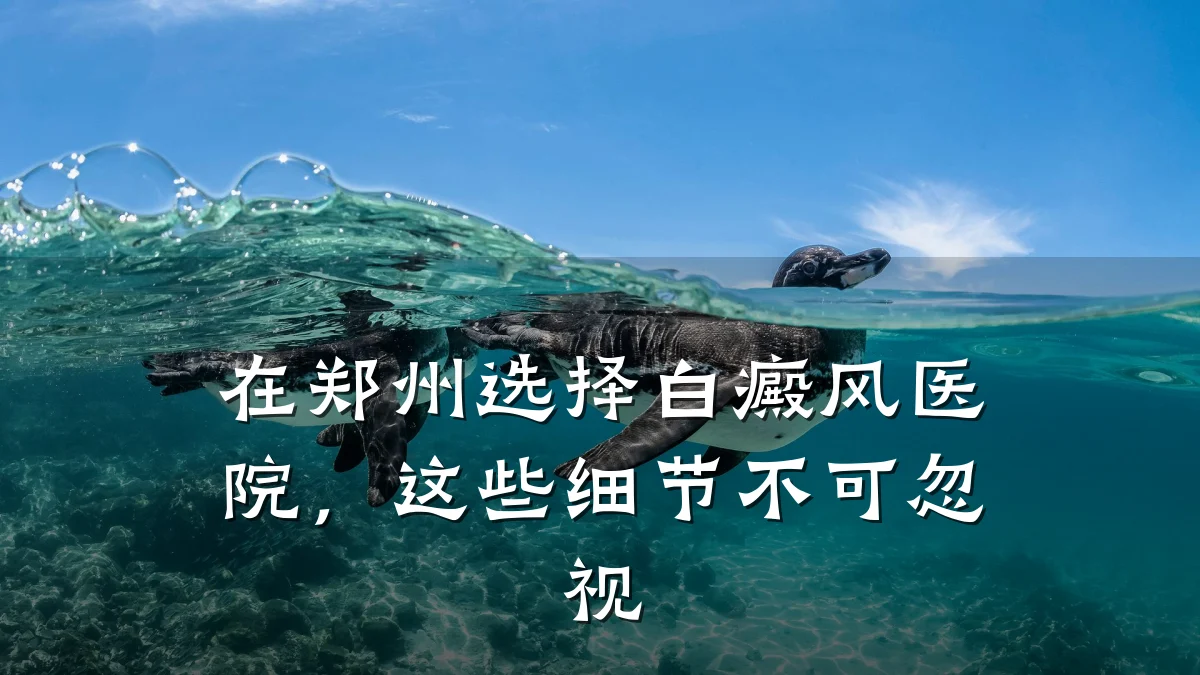 在郑州选择白癜风医院,这些细节不可忽视