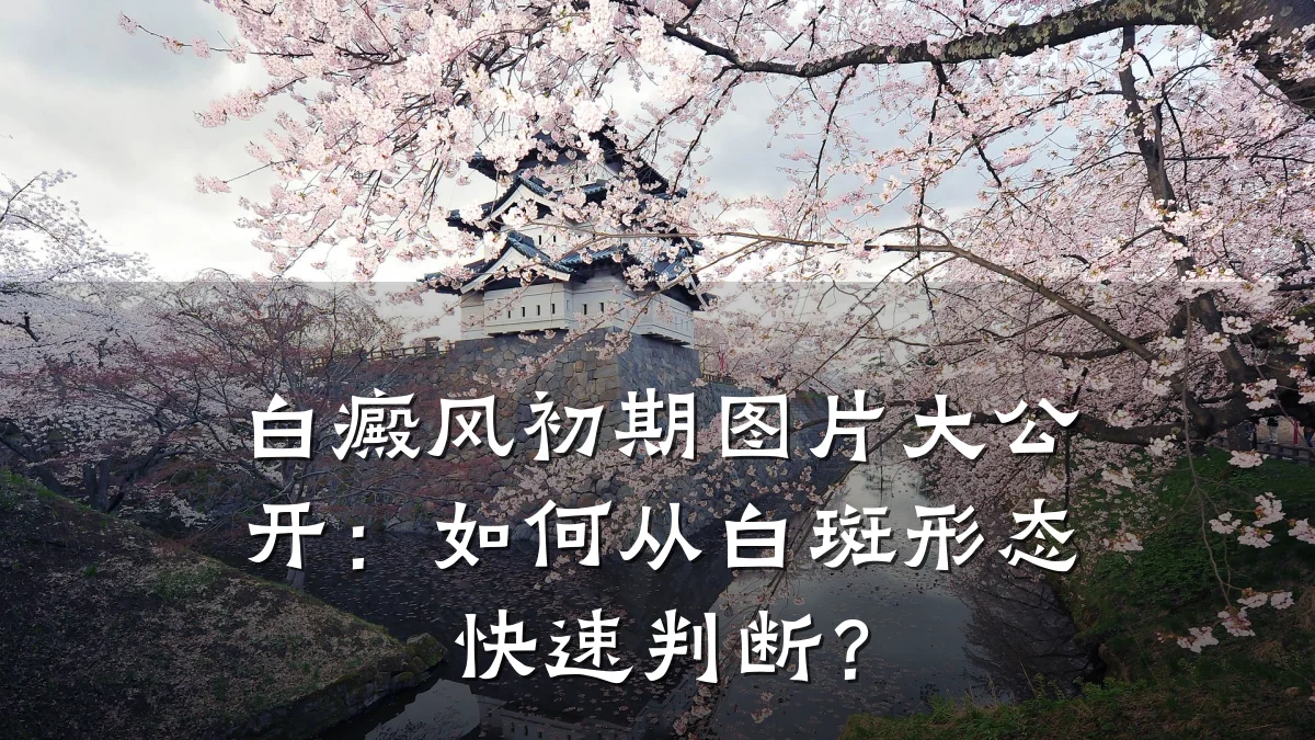 白癜风初期图片大公开:如何从白斑形态快速判断?