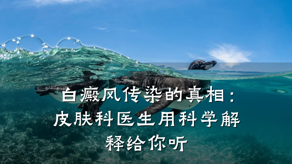 白癜风传染的真相:皮肤科医生用科学解释给你听