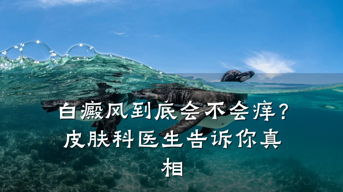 白癜风到底会不会痒?皮肤科医生告诉你真相